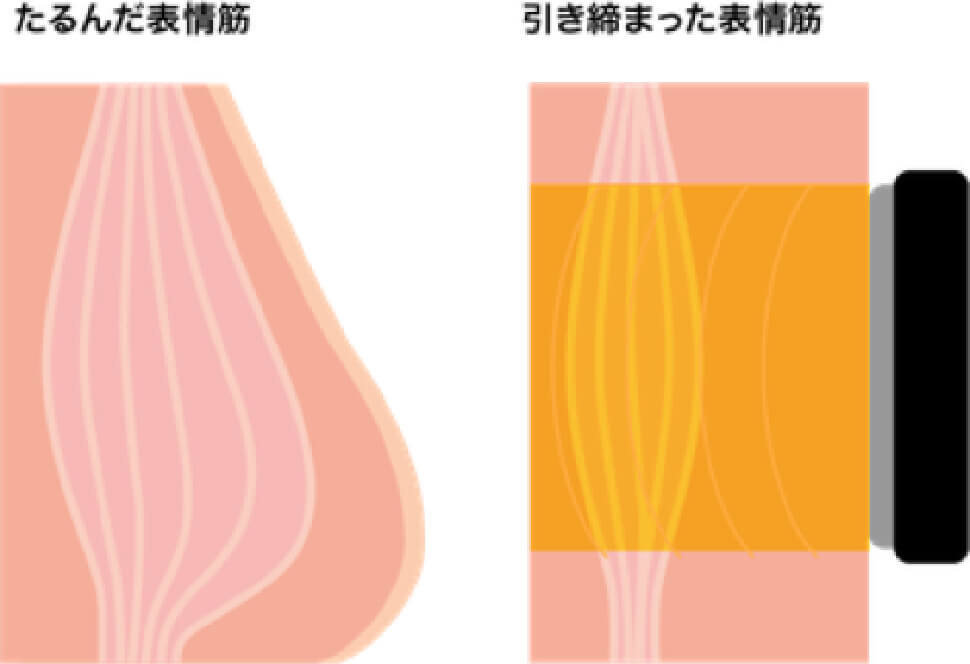 表情筋トレーニングとドレナージュ